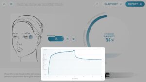 scs-elasticity1