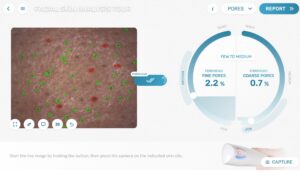 scs-pores1