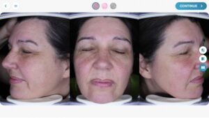 scs-visioface5